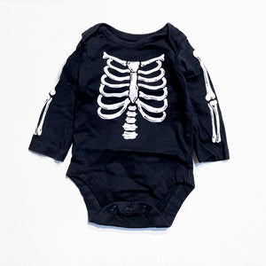 Children's Place Onesie 0-3M|158924