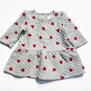 Gap Dress 12-18M|192589
