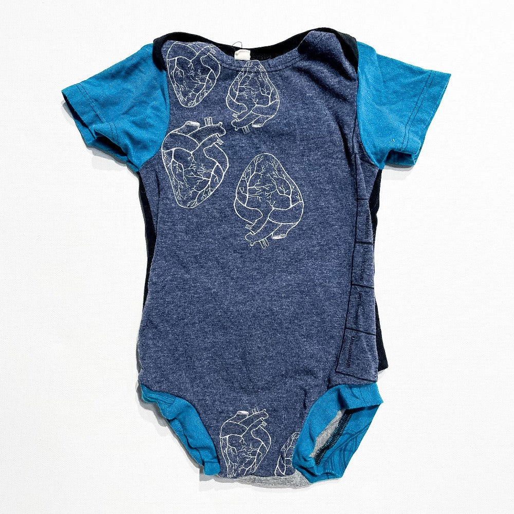 Onesie 3-6M|205961